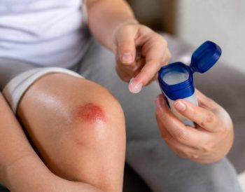 Vaseline sur plaie : est-ce une bonne idée pour favoriser la cicatrisation ?