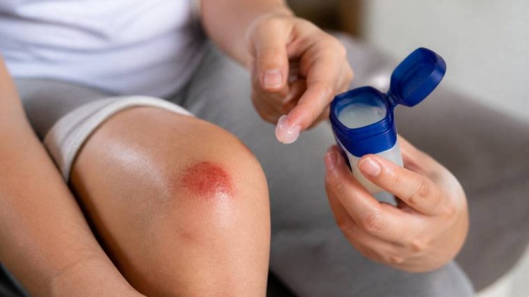 Vaseline sur plaie : est-ce une bonne idée pour favoriser la cicatrisation ?